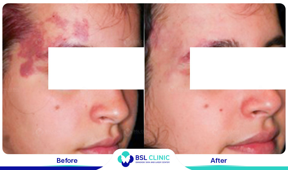 results-B&C-IPL