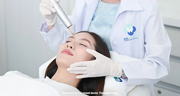 Laser for Dark Spots