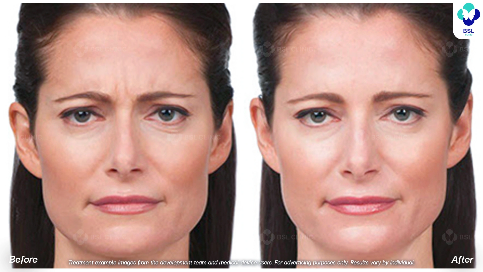 Treatment example images from the development team and medical device users. For advertising purposes only. Results vary by individual.