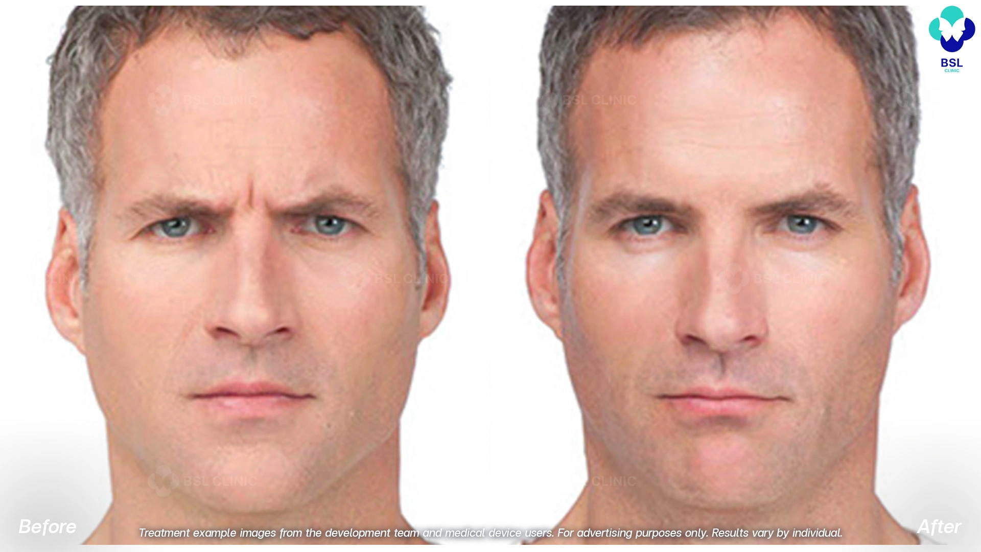 Treatment example images from the development team and medical device users. For advertising purposes only. Results vary by individual.