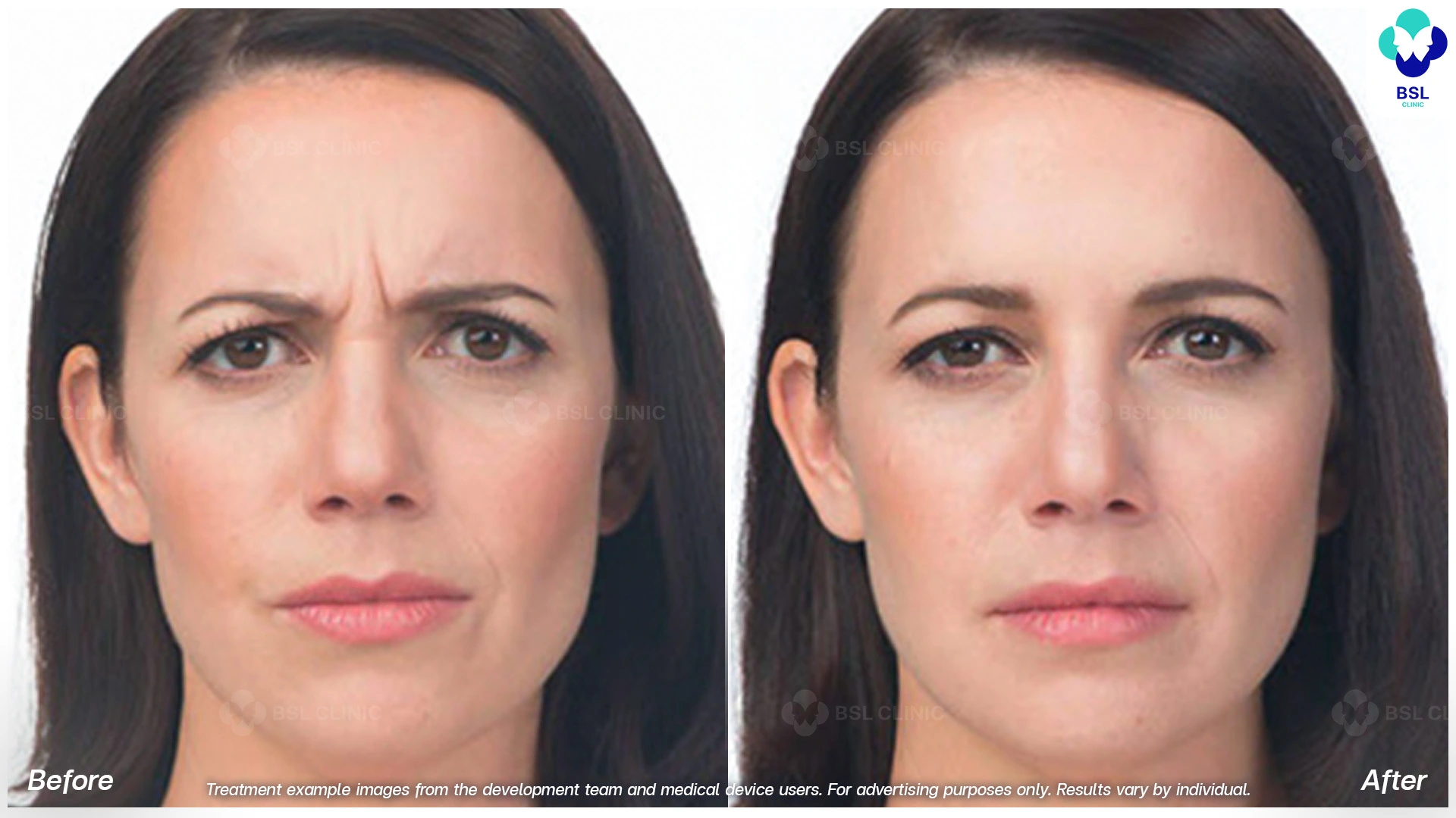 Treatment example images from the development team and medical device users. For advertising purposes only. Results vary by individual.